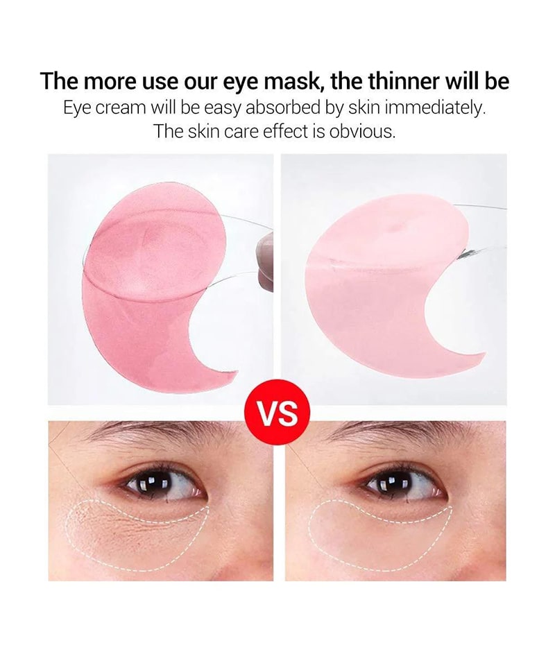 پچ چشم گل رز لانبنا